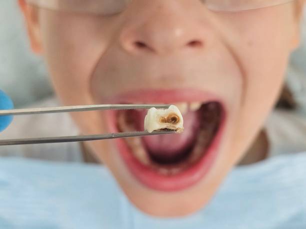 Best Tooth Infection Emergency Dentist  in Goldenrod, FL