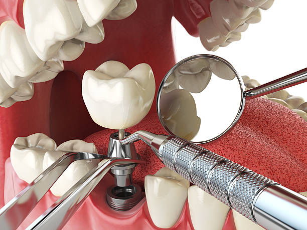 Best Broken Tooth Emergency  in Goldenrod, FL